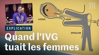 IVG dans la Constitution  quand lavortement tuait les femmes en France