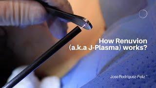 How Renuvion a.k.a J-Plasma works?