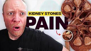 The Most PAINFUL Thing a Human Can Experience??  Kidney Stones