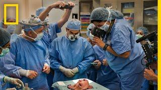Youngest Face Transplant Recipient in U.S.  National Geographic