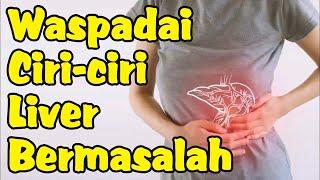 Ciri-ciri Liver Bermasalah yang Harus Diketahui