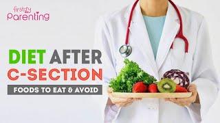 Diet After a C-Section Foods to Eat and Avoid