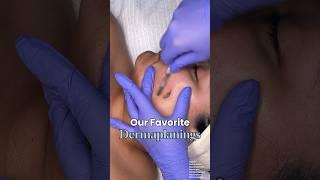 ASMR Dermaplaning Compilation