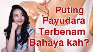 PUTING TERBENAM BERBAHAYA KAH? Fakta Kesehatan Payu dara  Clarin Hayes