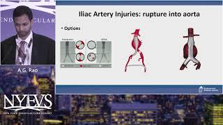 Iliac Artery Complications Management of Retroperitoneal Bleeds Perforations and Acute Occlusions