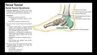 Tarsal Tunnel Syndrome  Clinical Anatomy & Presentation