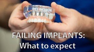 How long will my dental implants last ? Dental Implant questions  Durham Dental Solutions