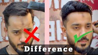 Buy Frontline Hair Patch  Front Hairline Loss  Permanent Hair Patch Delhi  Call  9650914665