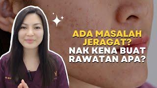 Beauty Tips  Ada masalah Jeragat Nak buat rawatan apa?