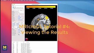 MRIcroGL Tutorial #4 Viewing the Results
