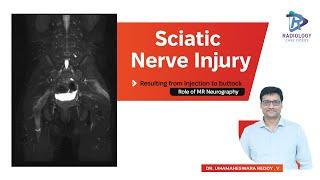 Sciatic Nerve Injury Resulting from Injection to buttock Role of MR Neurography #Damayanthi