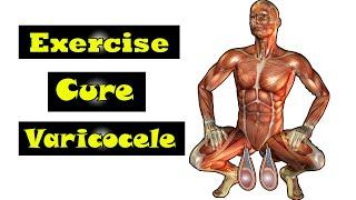 exercise for work cure varicocele