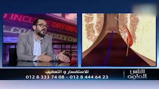 اعرف ايه طرق علاج الناسور الشرجي مع د #رامي_صلاح_الدين  في برنامج #الناس_الحلوة مع د #أيمن_رشوان