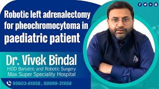 Robotic left adrenalectomy for pheochromocytoma in pediatric patient -  Dr. Vivek Bindal