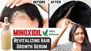 STOP Hairfall Grow Hair at Rocket speed treat Baldness from 1st week  MinoxidilSerum Men & Women