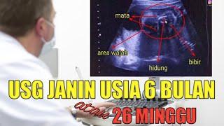 USG JANIN USIA 6 BULAN ATAU 26 MINGGU