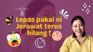 Beauty Tips   Lepas pakai ni Jerawat terus Hilang