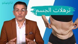 هل بعد التخسيس يحدث ترهلات للجسم وكيفيه التعامل معها ؟