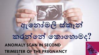 ඇනෝමලී ස්කෑන් එක කරන්නේ කොහොමද? Anomaly scan during pregnancy