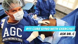 Can I Get Rid Of Gynecomastia With Exercise? Do I Have To Have Surgery? Ask Dr. C - Episode 11