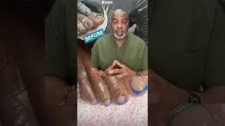 See A Doctor First Fungal Toenails & Cosmetics