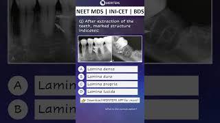 NEET MDS  INI-CET MDS  PSC  BDS - Most Important Questions  #neetmds2025 #mdsprep