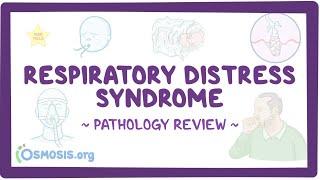 Respiratory distress syndrome Pathology Review