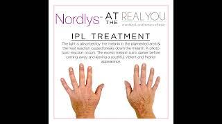 Nordlys IPL Hands IPL Male - Instagram Clip - Real You Clinic