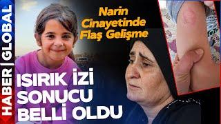 Narin Güran Cinayetinde Yeni Gelişme Adli Tıp Raporu Ortaya Çıktı Diş İzi Sonucu Belli Oldu