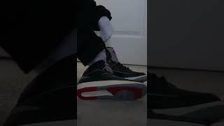 Might need a trip to the hospital in my Air Jordan 2 “Black Cement”