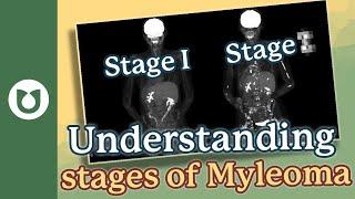 How does a patient know the stage of myeloma? #myeloma