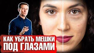 Мешки под глазами как убрать? Какая причина отека под глазами? 