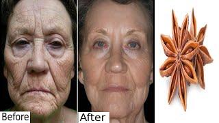 Wrinkle removal instant natural face lift homemade botox