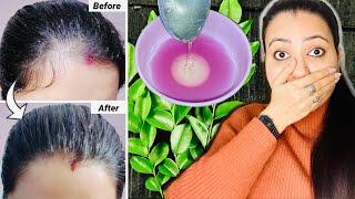 21 Days Summer Extreme Hair Growth Challenge  Grow your Hair faster Thicker and Longer in 3 Weeks