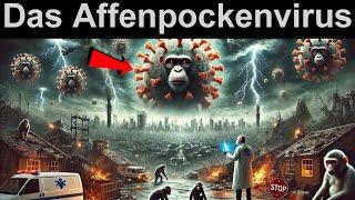 Endzeit-News  Das Affenpockenvirus kommt  Eine „weltweite Bedrohung”