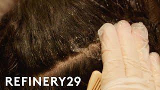 I Got A Scalp Facial To Treat Dandruff  Macro Beauty  Refinery29