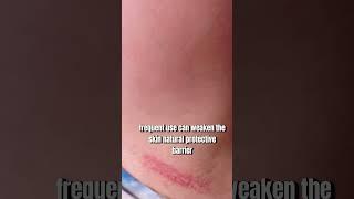 Watch This Before Using Hair Removal Creams ️Dermatology Tips