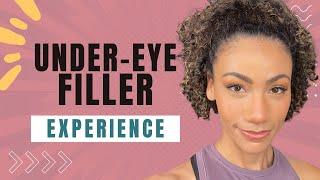 Biracial Under Eye Filler Before & After Experience  Juvederm Volbella