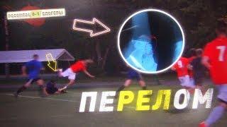 Герман сломал ногу в первом матче. БЛОГЕРЫ VS Россия24 серия #4 ПЕРВАЯ ИГРА