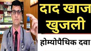 ringworm treatment  दाद खाज खुजली की दवा homeopathic treatment