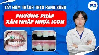 Tẩy Đốm Trắng Trên Răng Bằng Phương Pháp Xâm Nhập Nhựa Icon  Nam Bùi Vinalign Phần 2