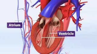 Atrial Fibrillation Animation Explained AFib & Risk of Stroke