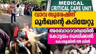 Snake Master Vava Suresh in Critical Condition Bitten by a Capturted Cobra at Kottayam