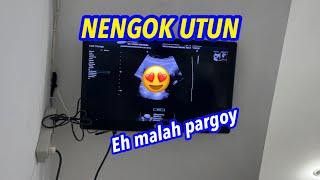 NENGOKIN UTUN YUUKK.. Seneng ketemu ibuk sampe pargoy di perut