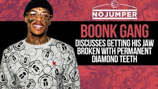 Boonk discusses Getting His Jaw Broken with Permanent Diamond Teeth