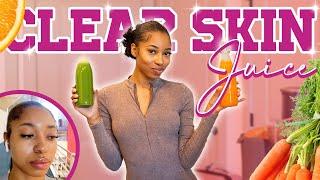 CLEAR SKIN Juicing Recipe + Immune Boosting   Vlogmas Day 4