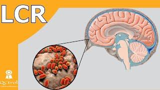 Cerebrospinal fluid CSF Chemical cytological and culture analysis