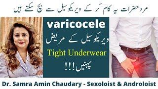 Varicocele Treatment  How to Prevent Varicocele  ویریکوسیل کا آسان علاج