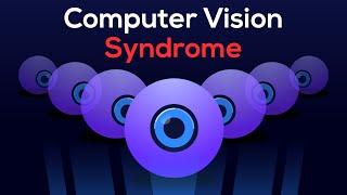 How I CURED my EYE STRAIN Relief from Computer Vision Syndrome 
