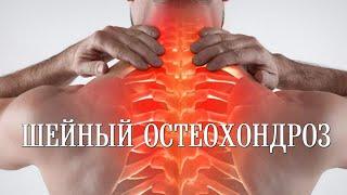 Шейный остеохондроз и как от него избавиться  Cervical osteochondrosis and how to get rid of it